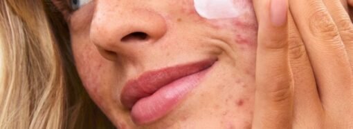 Score $158 Worth of Skincare for $59