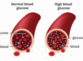 How to Control Blood Sugar in Diabetes: Effective Tips and Strategies