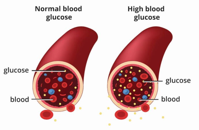 How to Control Blood Sugar in Diabetes: Effective Tips and Strategies