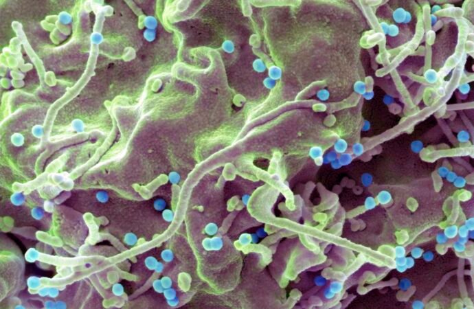 A new one-a-day-pill holds promise for HIV's 'forgotten population'