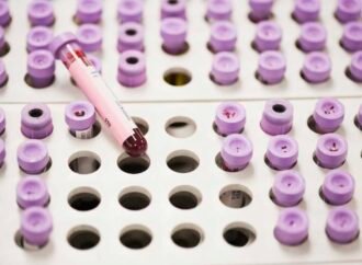 New guidelines offer updated approach for managing high cholesterol : NPR