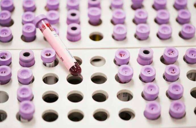 New guidelines offer updated approach for managing high cholesterol : NPR