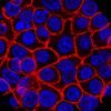 Experimental pill promises new hope for deadly pancreatic cancer : NPR