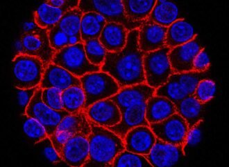 Experimental pill promises new hope for deadly pancreatic cancer : NPR