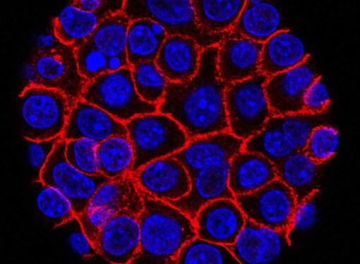 Experimental pill promises new hope for deadly pancreatic cancer : NPR