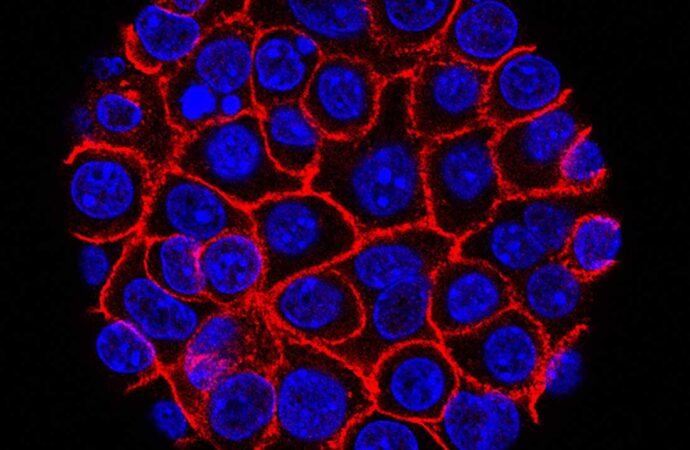 Experimental pill promises new hope for deadly pancreatic cancer : NPR