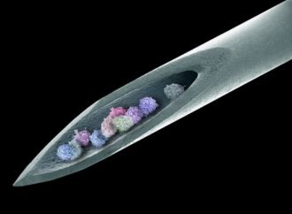 Stem cells banish severe autoimmune disease for 15 years