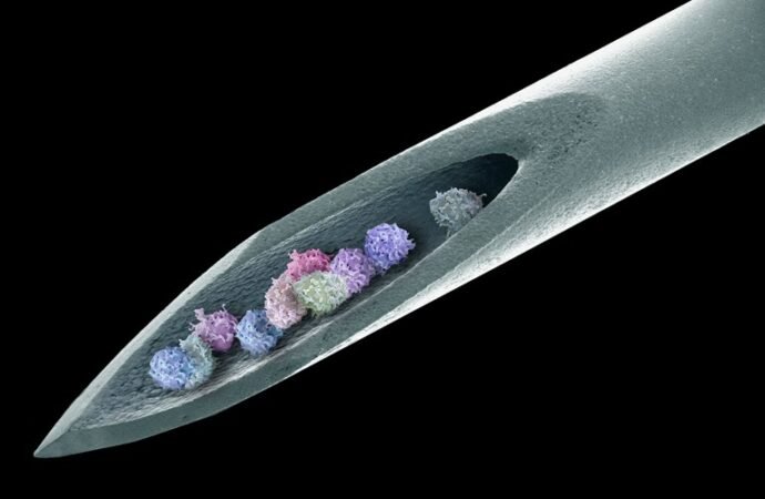 Stem cells banish severe autoimmune disease for 15 years