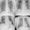 Astronauts take first x-rays in space