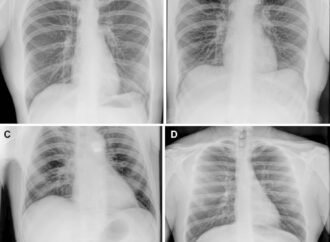 Astronauts take first x-rays in space