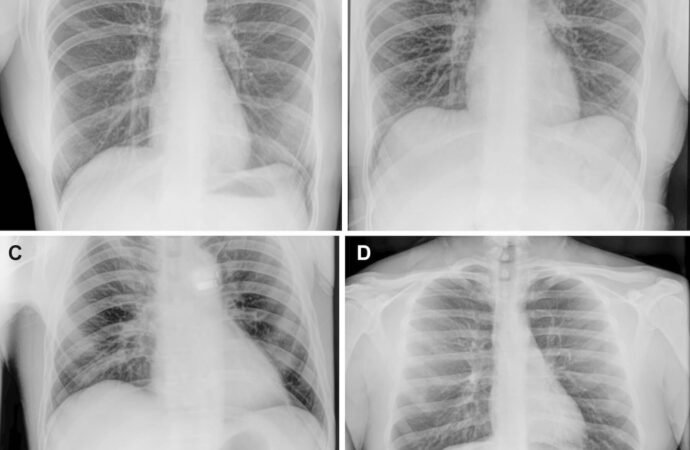 Astronauts take first x-rays in space