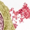 Biologists point out how a common virus triggers multiple sclerosis
