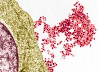 Biologists point out how a common virus triggers multiple sclerosis