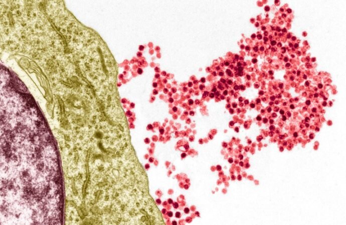 Biologists point out how a common virus triggers multiple sclerosis