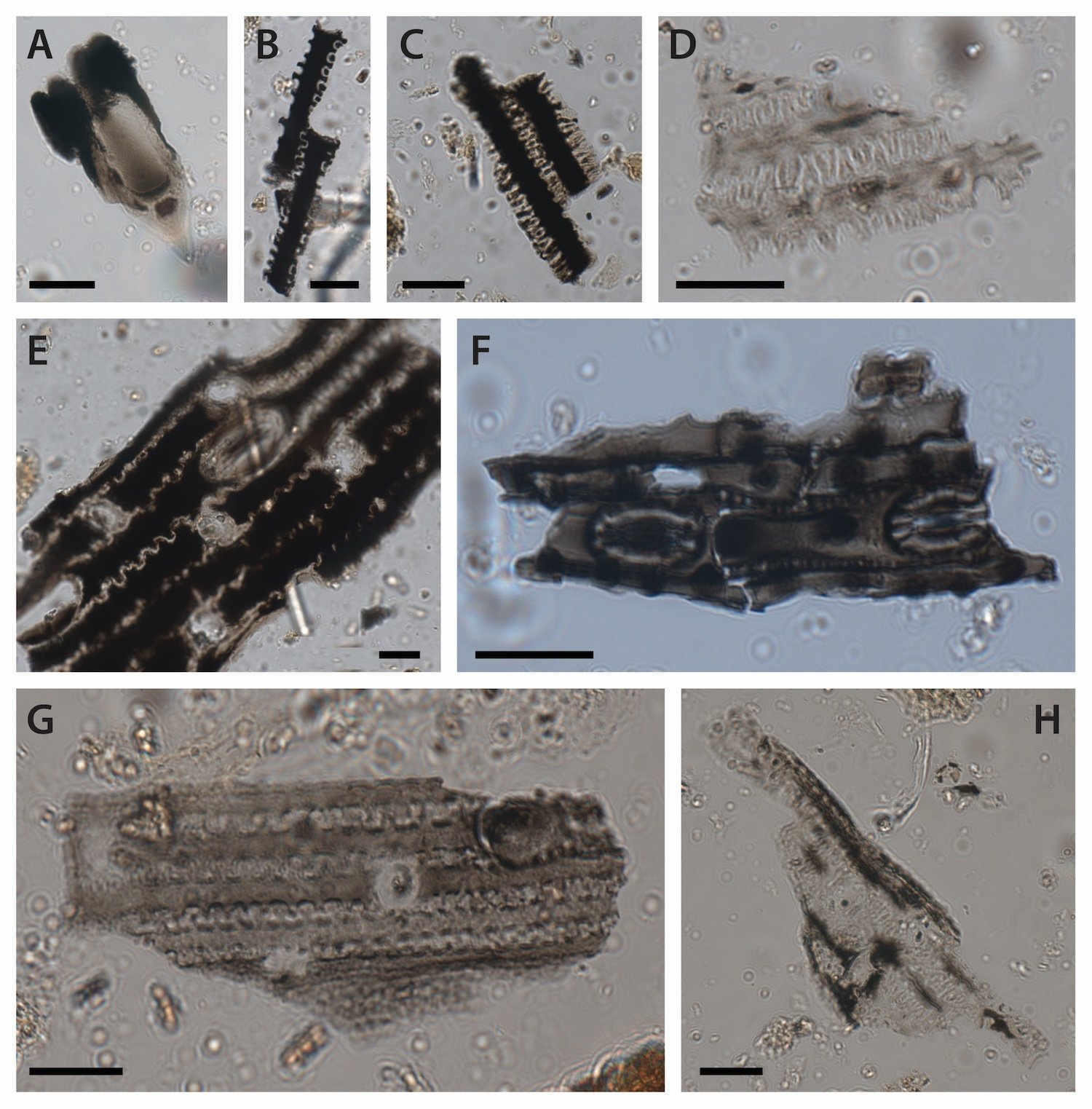 Microscopic images of burnt grass phytoliths from Cloggs Cave. Most images represent phytoliths of grass inflorescences and leaves. The scale bar indicates 20 microns. See the magazine article for more details. Credit: Grono, GunaiKurnai Land and Waters Aboriginal Corporation, et al.