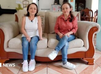 Could these twins’ rare genetic disorder provide the key to preventing cancer?