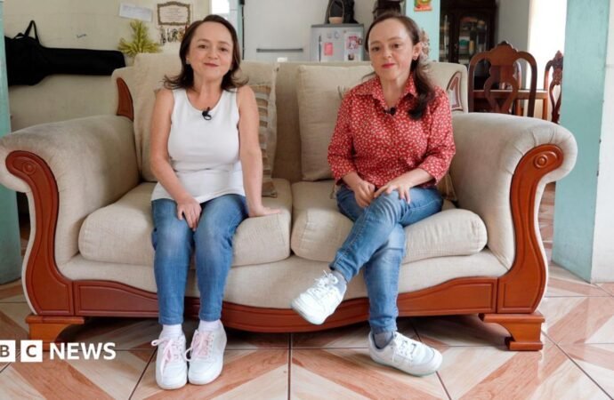 Could these twins’ rare genetic disorder provide the key to preventing cancer?