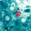 ‘Explosive diarrhea’ outbreak grips US: How researchers search for its origin