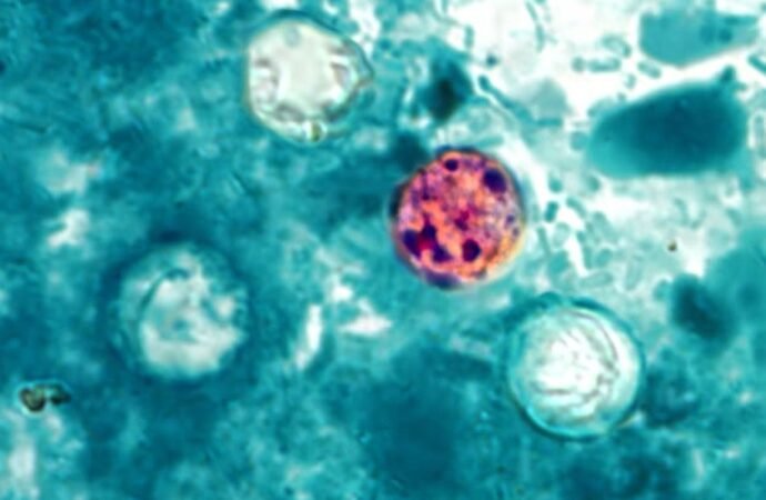 ‘Explosive diarrhea’ outbreak grips US: How researchers search for its origin