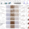 GPC3-Specific dnTGFβRII-Armored CAR T Cells for Hepatocellular Carcinoma – Nature