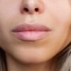 In the search for the ‘Instagram face’, are we losing the imperfections that make us human?