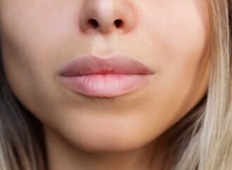 In the search for the ‘Instagram face’, are we losing the imperfections that make us human?