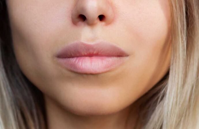 In the search for the ‘Instagram face’, are we losing the imperfections that make us human?