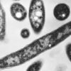 New cases slow in New York Legionnaires’ disease outbreak; Met Museum between buildings with positive tests
