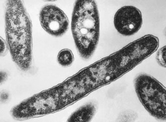 New cases slow in New York Legionnaires’ disease outbreak; Met Museum between buildings with positive tests