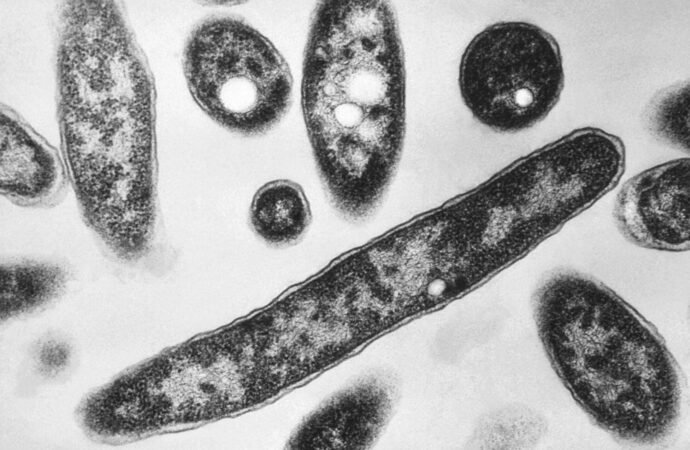 New cases slow in New York Legionnaires’ disease outbreak; Met Museum between buildings with positive tests