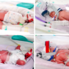 Rare identical quadruplets born in Australia