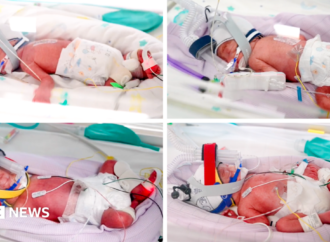 Rare identical quadruplets born in Australia