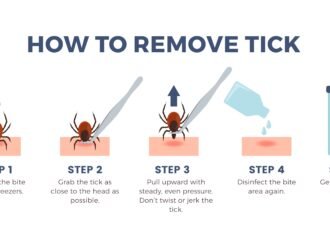 The Dos and Don’ts of Removing a Tick