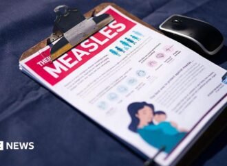 The United States records the highest number of measles cases in 35 years
