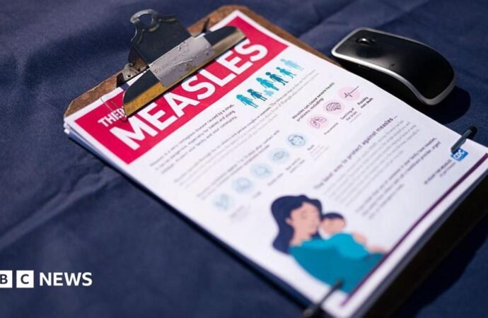 The United States records the highest number of measles cases in 35 years