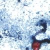 The outbreak of the parasite that causes diarrhea exceeds 1,000 cases