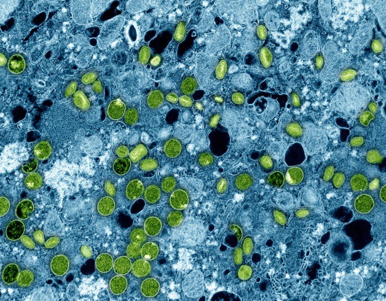 A color transmission electron micrograph of circular green monkeypox virus particles inside cultured blue cells