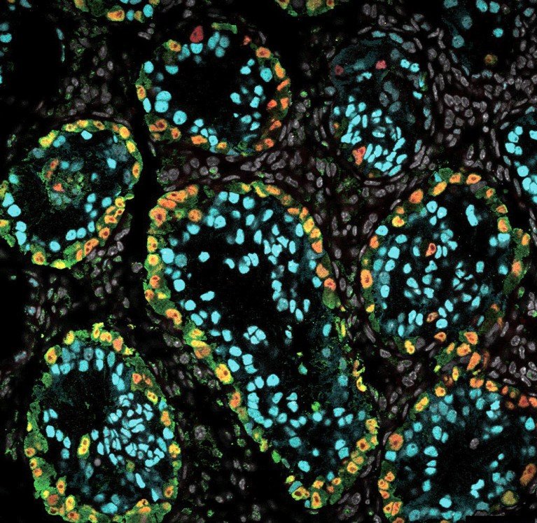 High-magnification microscopy image showing xrTestis green fluorescent protein 1 month after transplantation in a rhesus macaque.