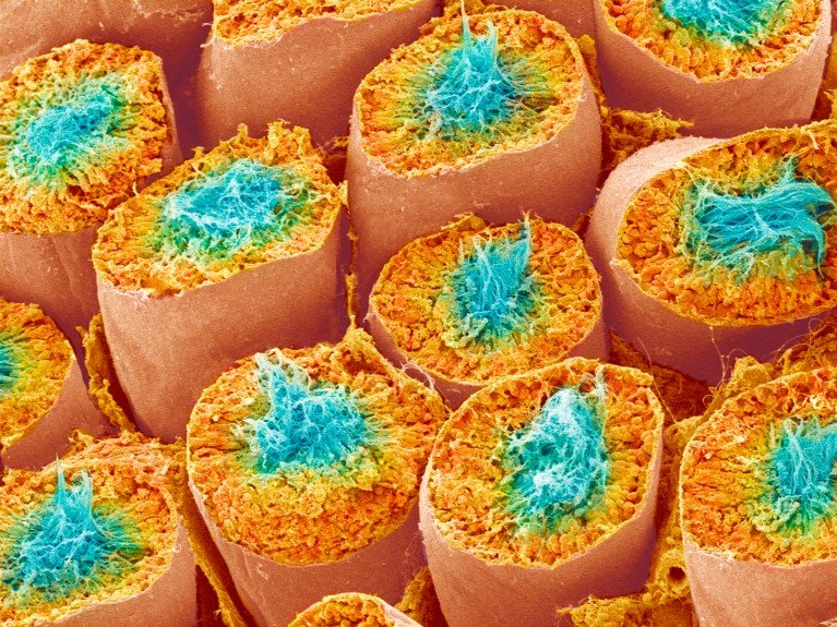 A color scanning electron micrograph of a cross section through a repeating pattern of orange circular seminiferous tubules, containing blue human sperm.