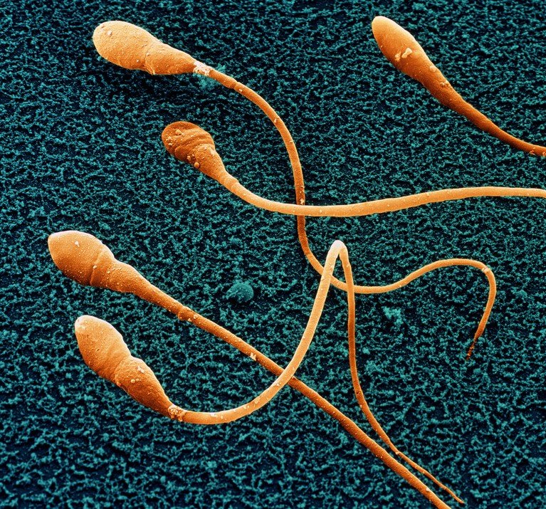 Color scanning electron micrograph of human sperm.