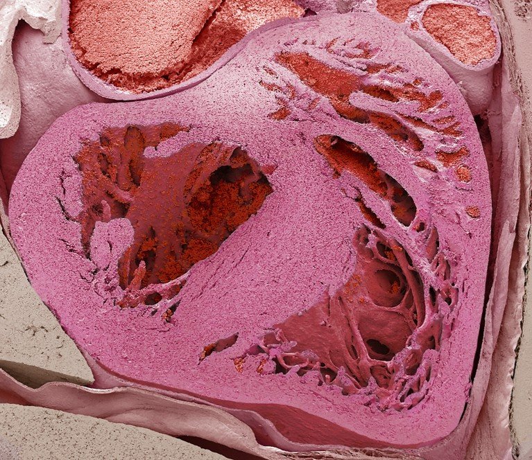 Color scanning electron micrograph of a cross section of the heart of a mouse embryo, showing the internal chambers and tissue structures in shades of pink and red.