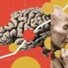 A controversial Alzheimer’s surgery is said to reverse symptoms — here’s what scientists know