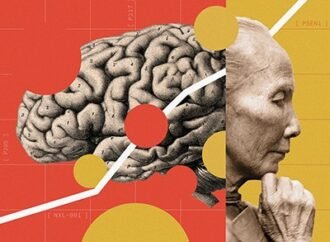 A controversial Alzheimer’s surgery is said to reverse symptoms — here’s what scientists know