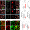 Aberrant excitatory neuronal ERBB4 promotes Alzheimer’s disease pathology – Nature