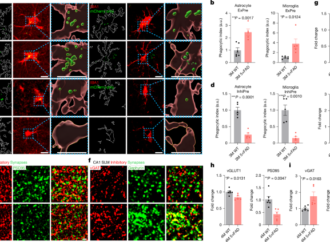 Aberrant excitatory neuronal ERBB4 promotes Alzheimer’s disease pathology – Nature