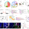 Antigen presentation by CD40+MHC-II+ astrocytes promotes CNS autoimmunity – Nature