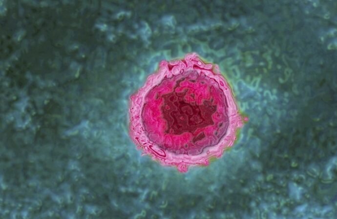 COVID can wake up a slew of dormant viruses inside you