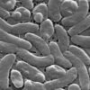 Flesh-eating bacteria infections are surging along the Gulf Coast with five deaths reported in Louisiana | Fortune