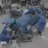 Moment earthquake shakes hospital operating room in Japan