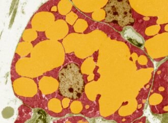More muscle, less belly fat: mutations to a gene are linked to wide-ranging benefits